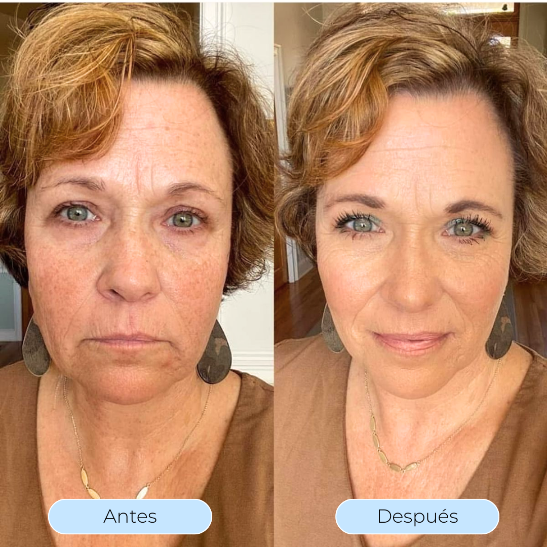 Hydra Derm™ - El sérum que desafía al tiempo