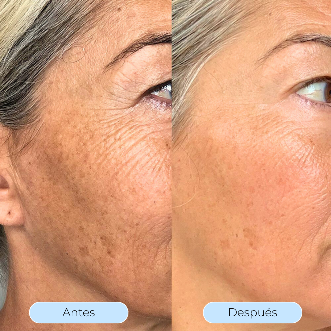 Hydra Derm™ - El sérum que desafía al tiempo