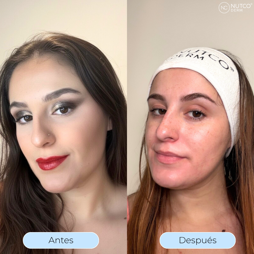 Oil Derm- Aceite limpiador
