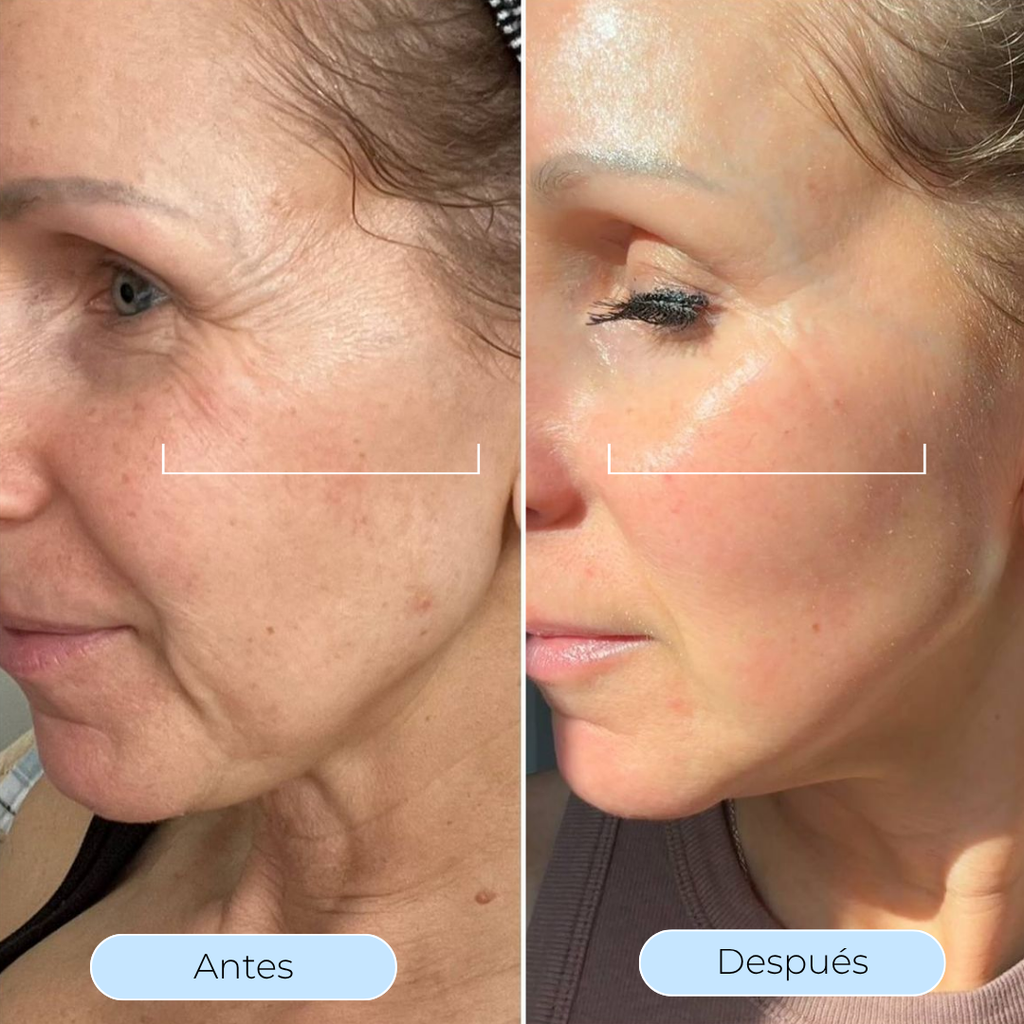 Hydra Derm™ - Sérum Menopausia