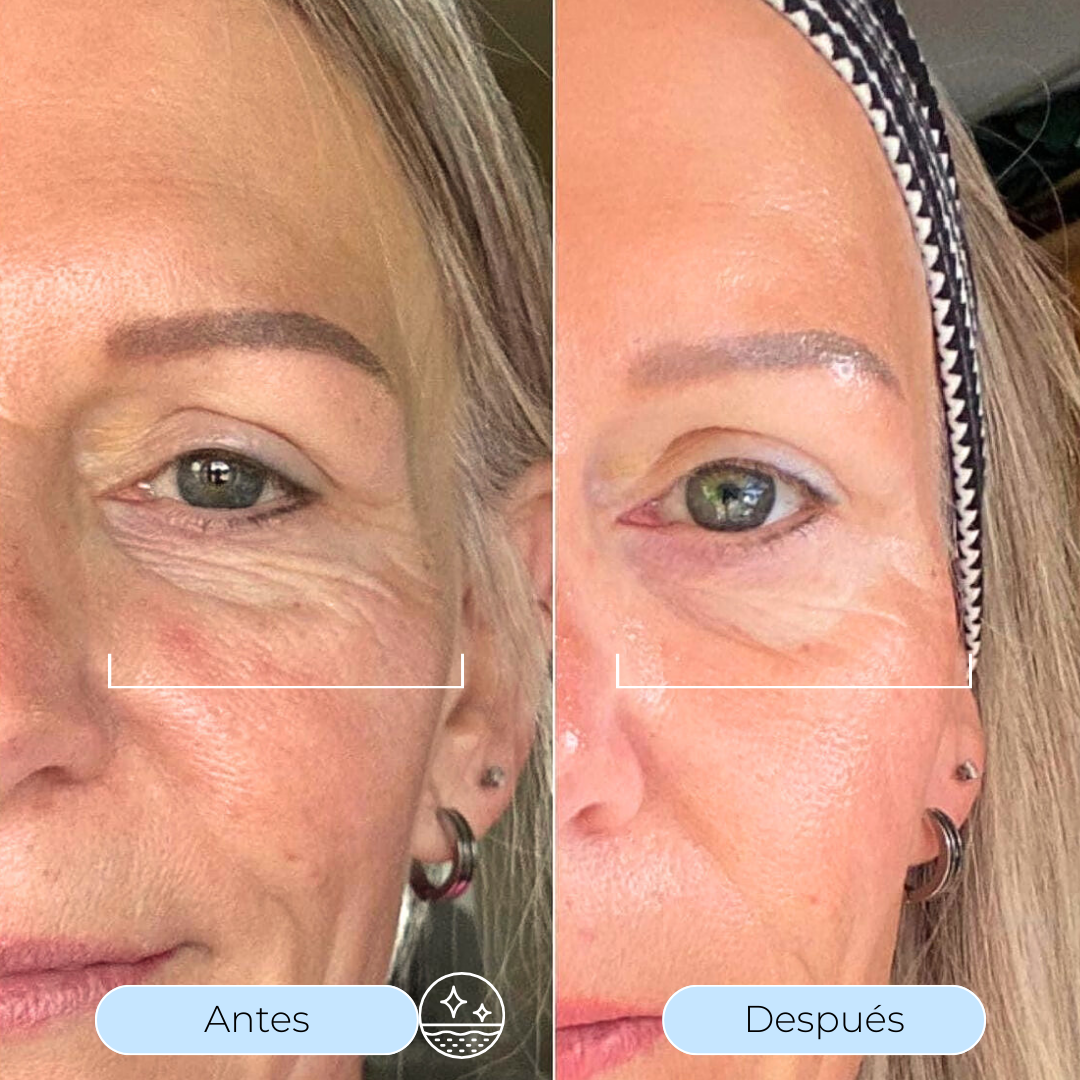 Hydra Derm™ - Sérum Hidratante con Ácido Hialurónico