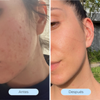 Hydra Derm™ - El sérum que desafía la hidratación