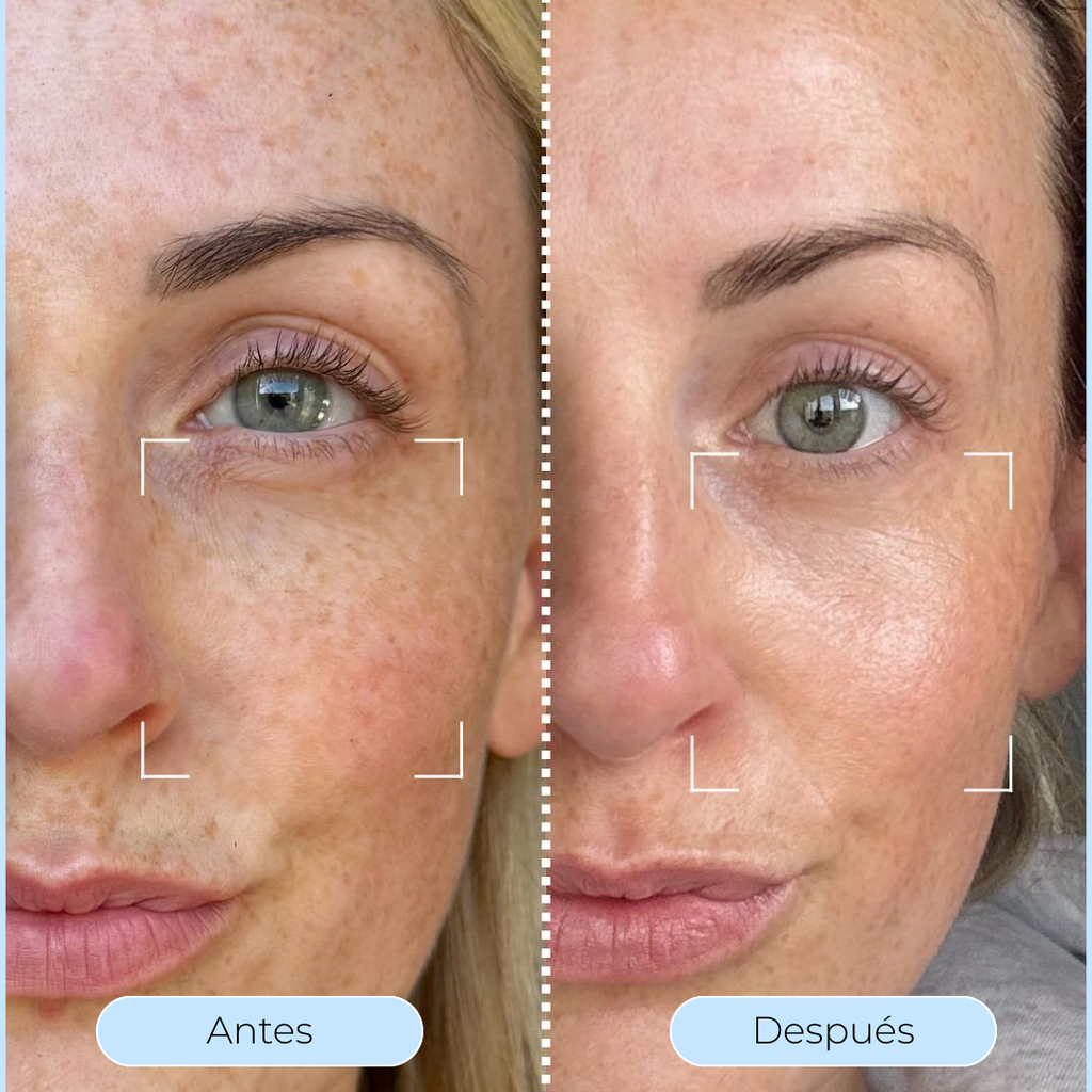 Hydra Derm™ - Piel más lisa y luminosa