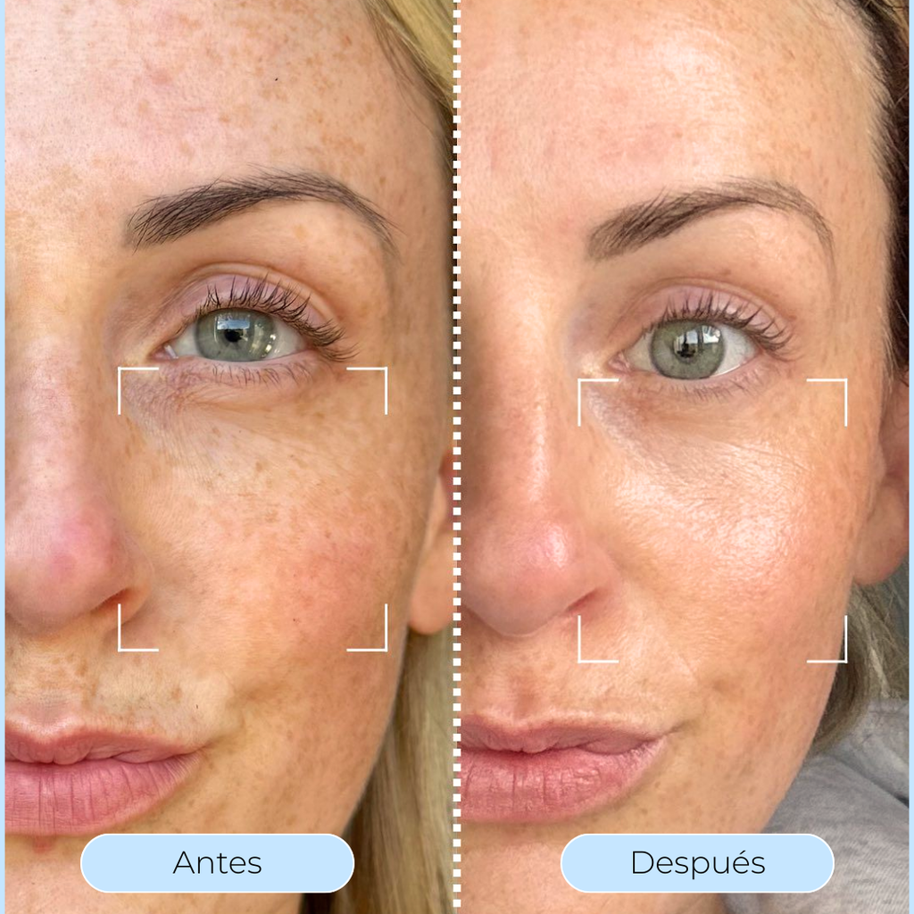 Hydra Derm™ - El sérum que revoluciona tu piel