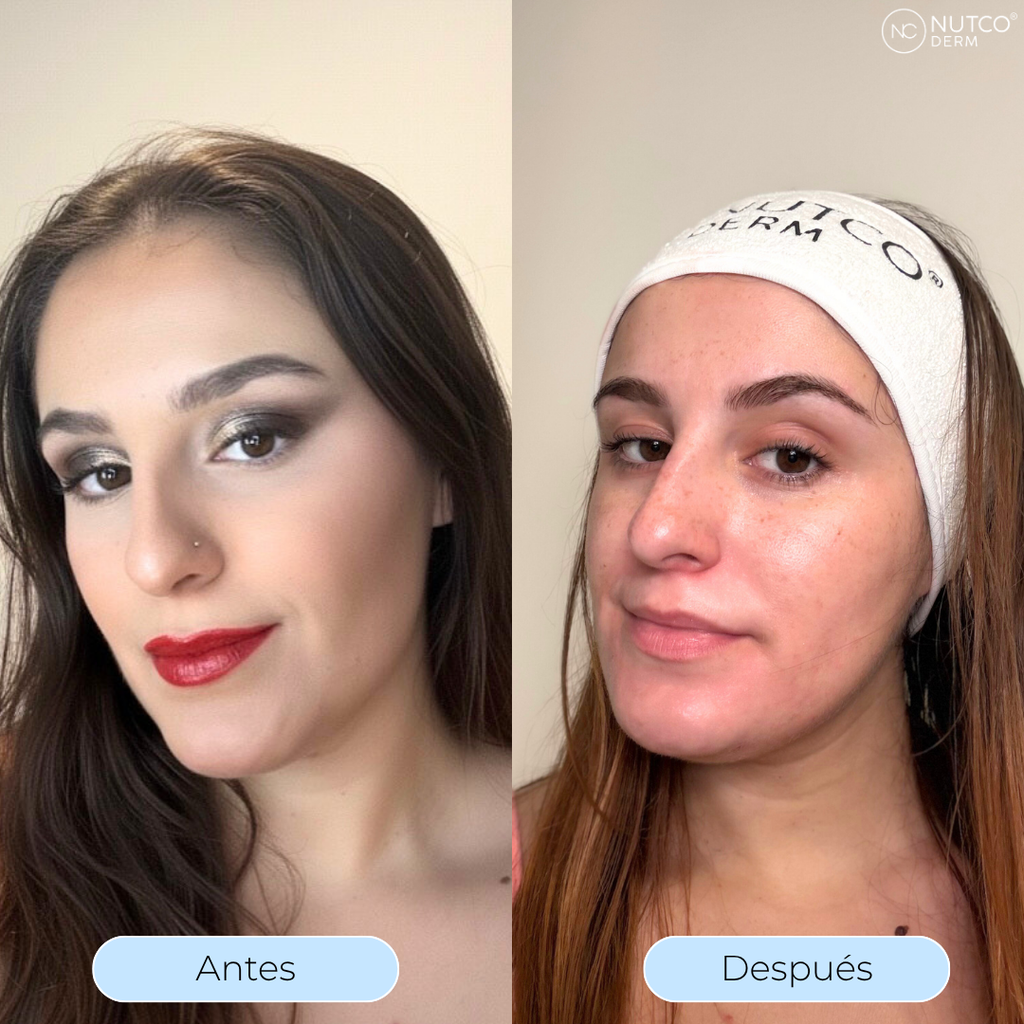 Oil Derm- Aceite limpiador