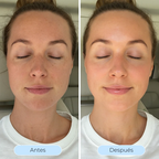 Hydra Derm™ - El sérum que desafía la hidratación