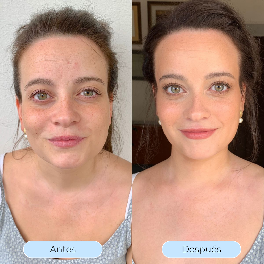 Hydra Derm™ - El sérum que revoluciona tu piel