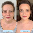 Hydra Derm™ - El sérum que revoluciona tu piel